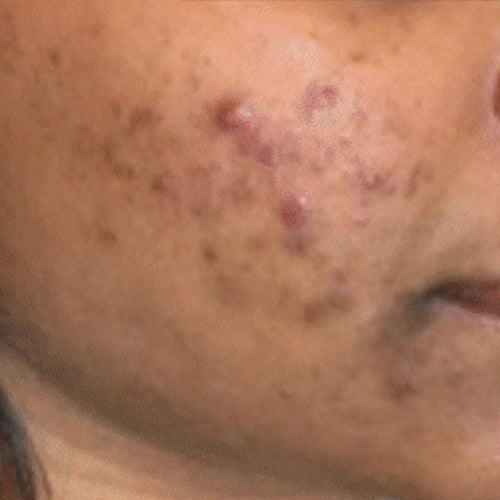 Before Muhammad Taha