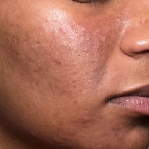 Before Screen UV60 w/ Aloe Vera (SPF 60)