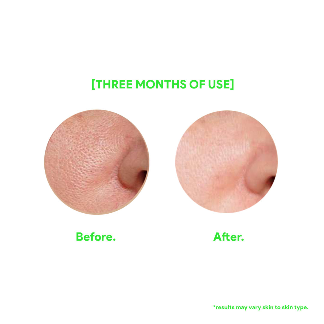 The Barrier Repair Serum with Ceramides and Oatmeal - Fuzed Skincare