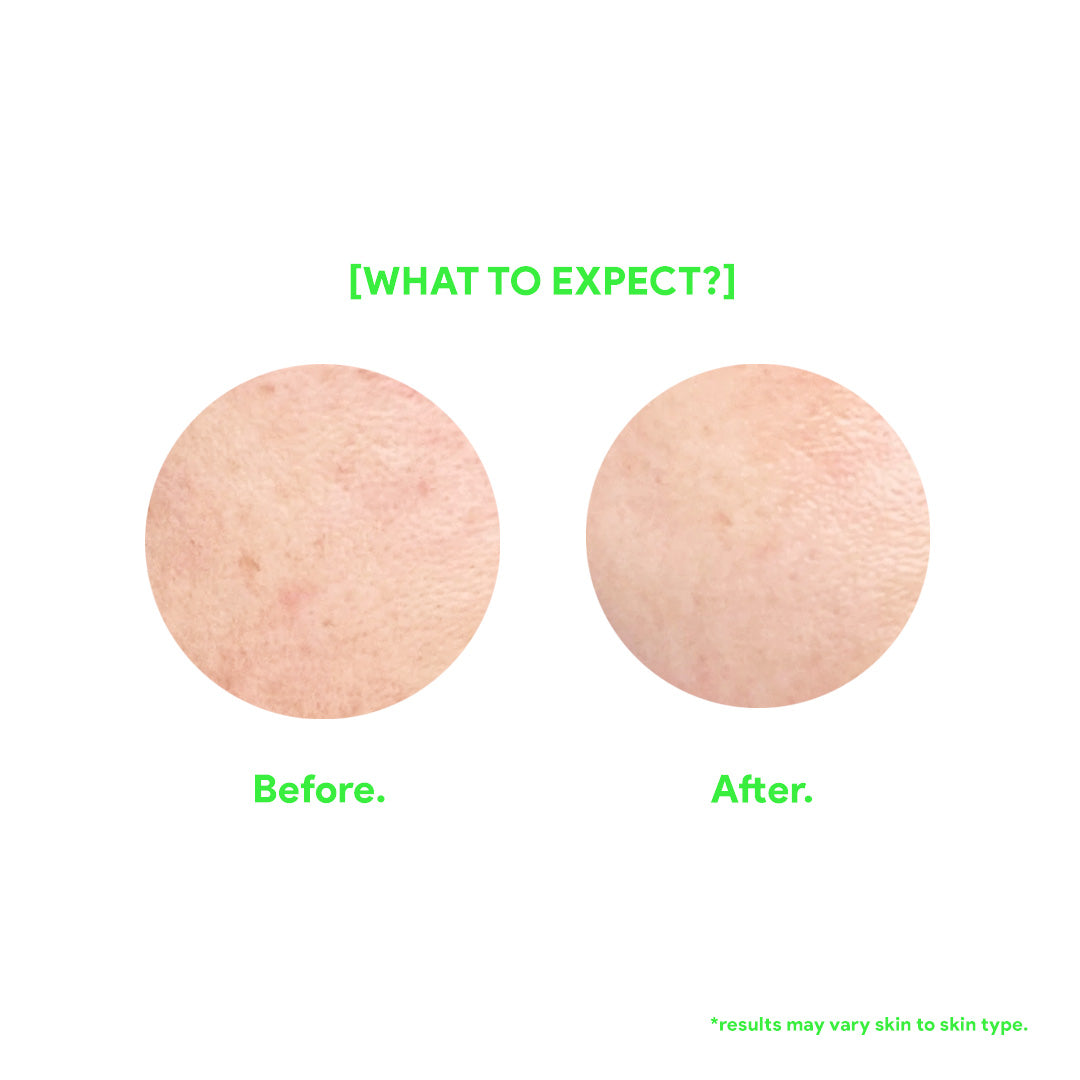 The Hydrating Facewash with Ceramides - Fuzed Skincare