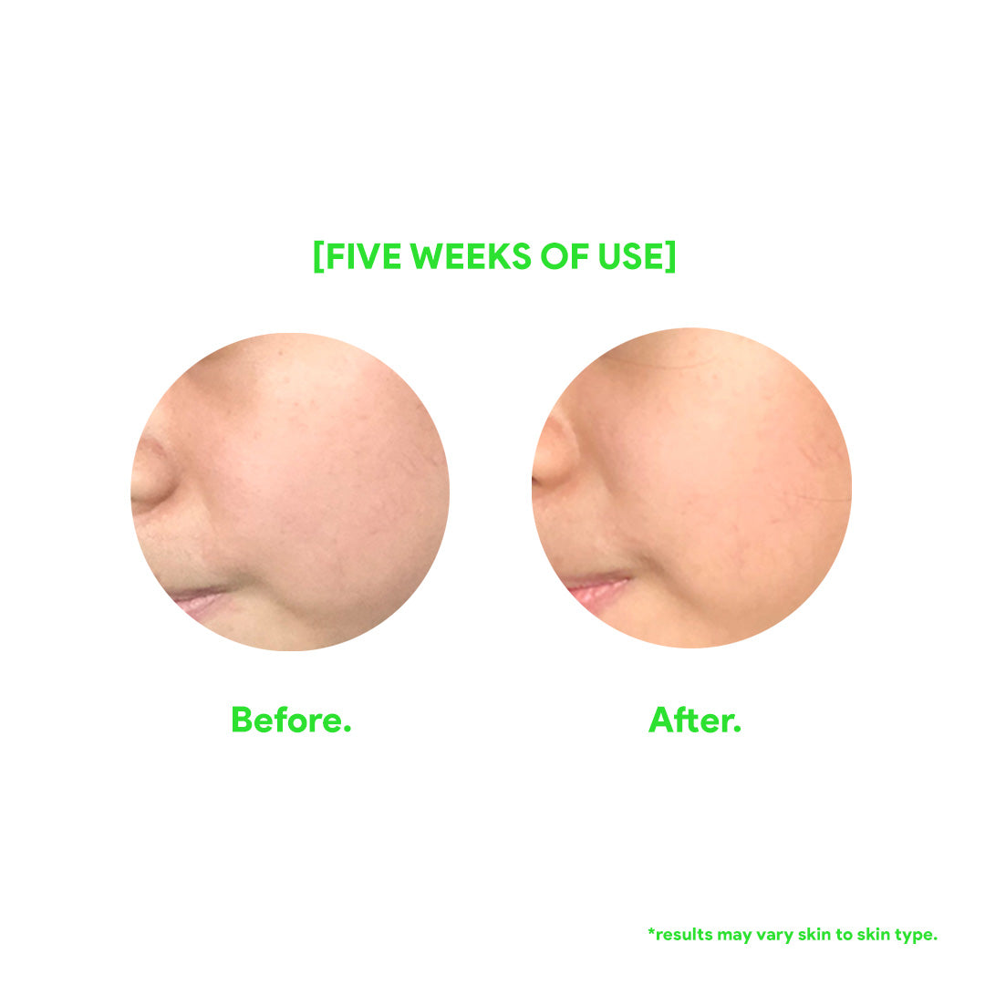 Screen UV60 w/ Aloe Vera (SPF 60) - Fuzed Skincare