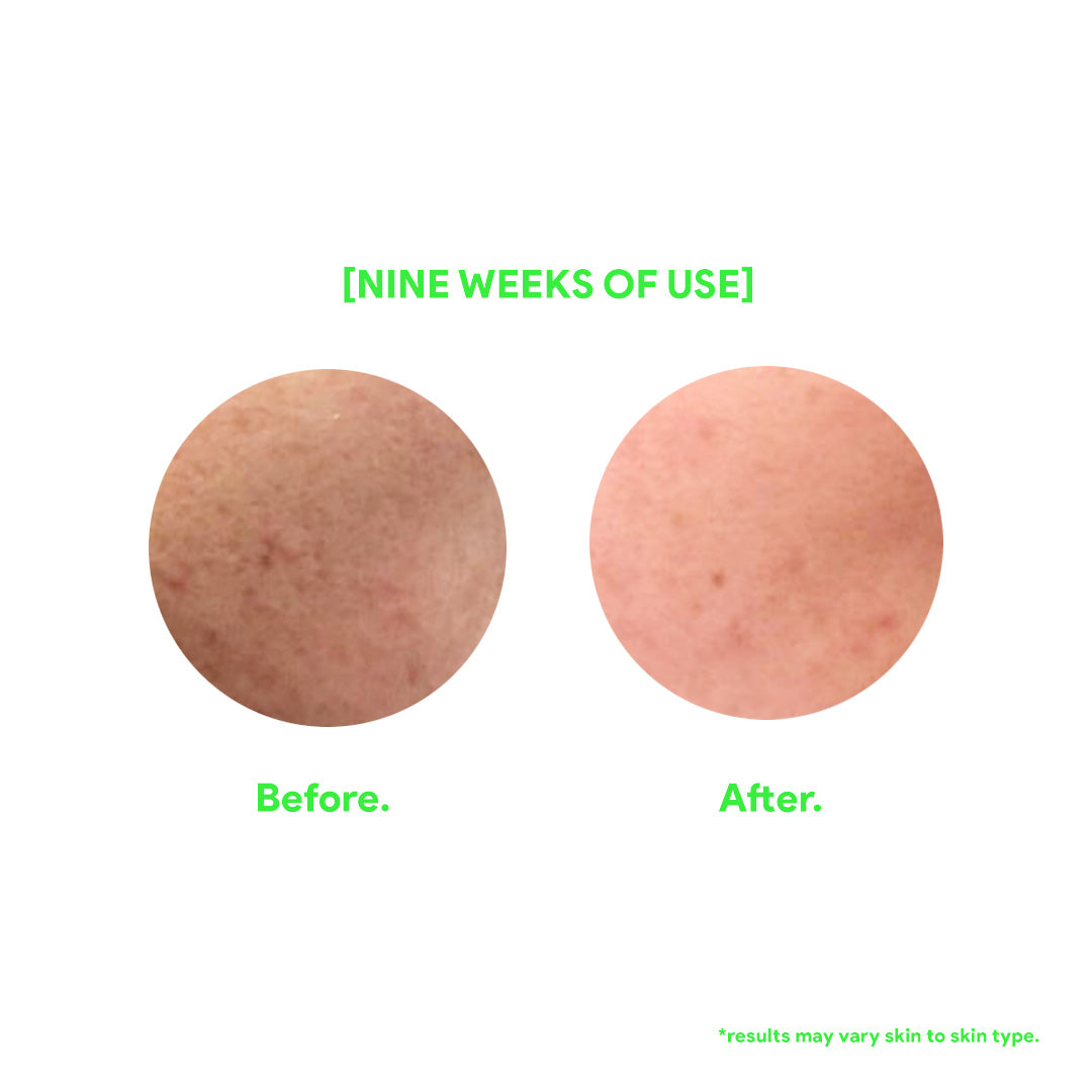 Sunscreen Spray with Thermal Spring Water (SPF 50) - Fuzed Skincare