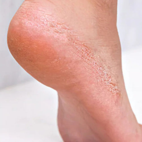 Before Muhammad Taha